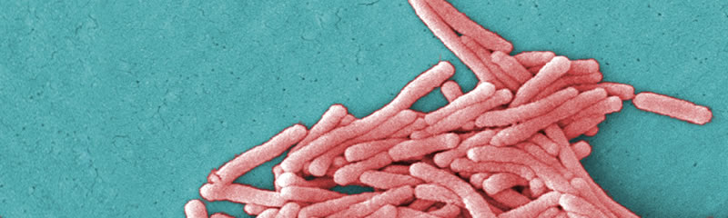 Legionella bacteria